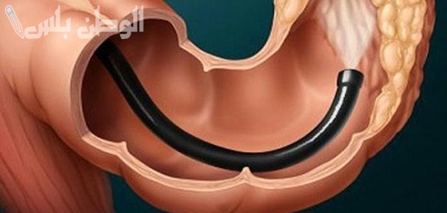 عشبة سحرية مذهلة.. تنظف القولون وتخلصك من السموم بسرعة