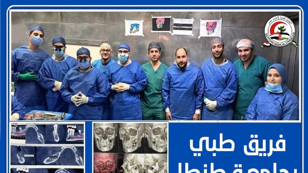 نجاح باهر لفريق طبي بجامعة طنطا في استئصال ورم خبيث بالفك لسيدة