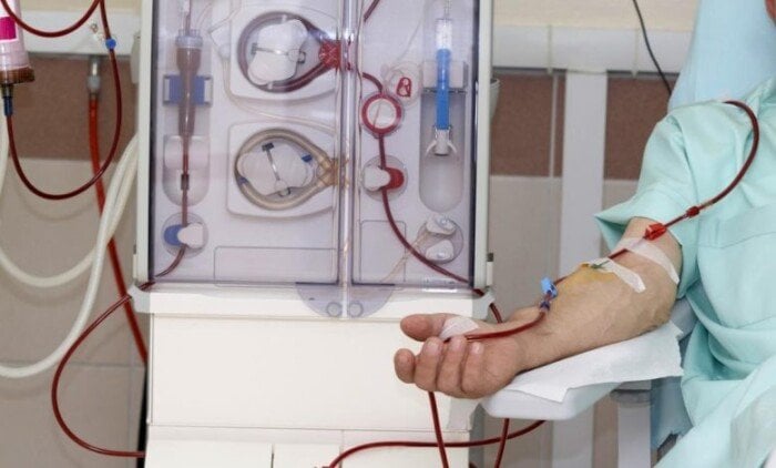 نفى «مجلس الوزراء» زيادة أسعار الغسيل الكلوي