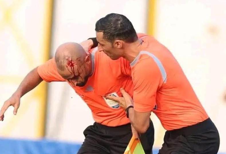 عقوبات قاسية تواجه البنزرتي بعد تعرض حكم المباراة للإصابة بمقذوف